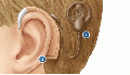 Cochlear2.gif