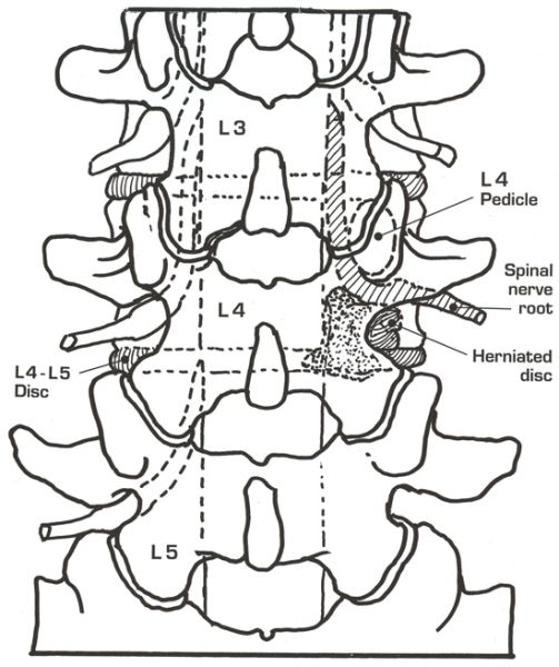 Fil:Lumbalanatomib.jpg