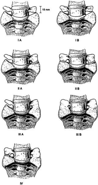 Fil:The Castellvi system.jpg