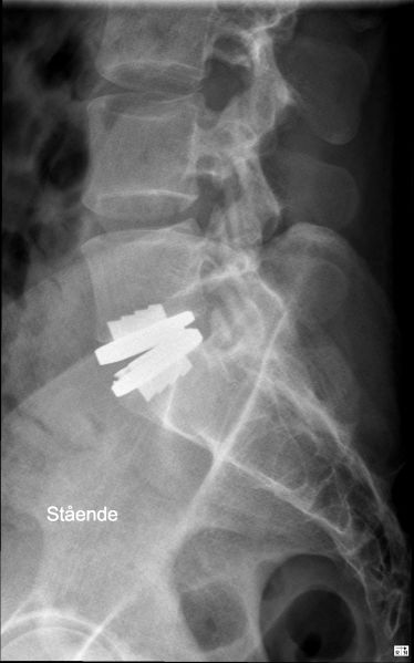 Fil:Prodisc-l.jpg