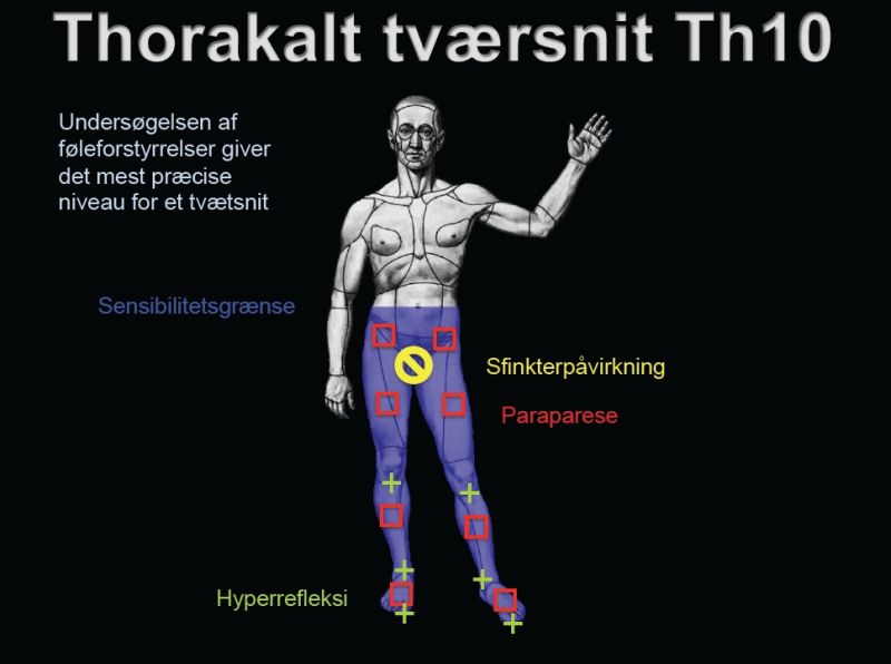 Fil:Th10 tvaersnit.jpg